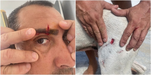 Vídeo: casal é atacado por pitbull solto em Arraial do Cabo e homem fica ferido no rosto