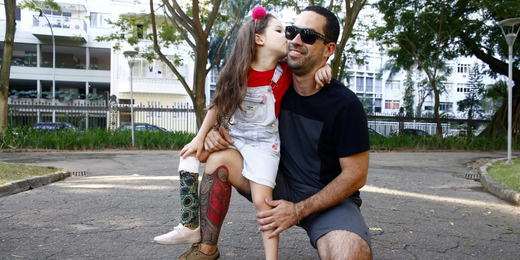 Em homenagem à filha de 5 anos, pai tatua prótese em uma das pernas