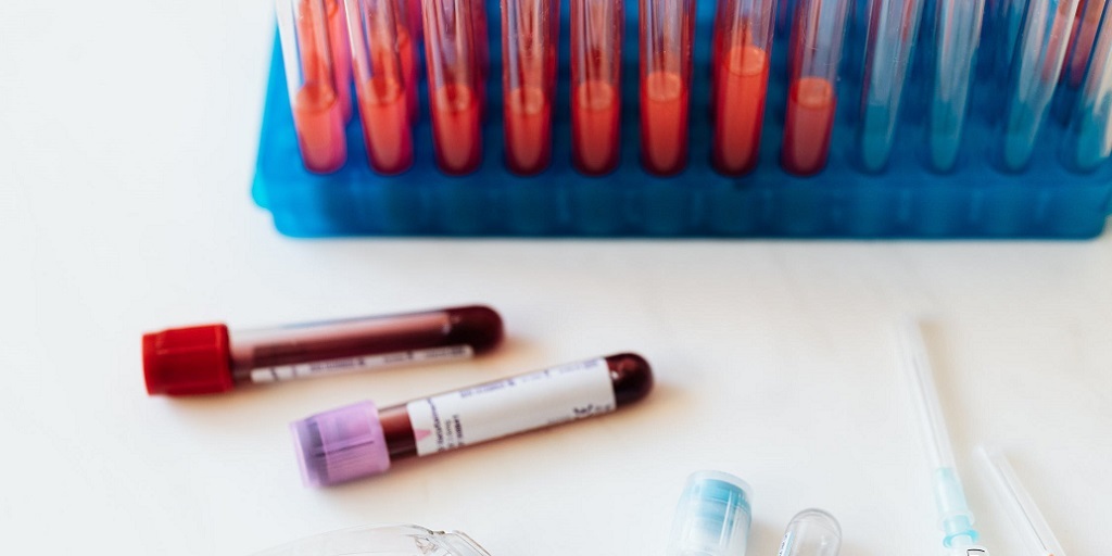 Confira os números da pandemia de covid-19 em Nova Friburgo