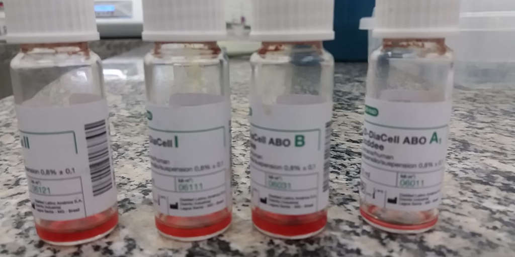 Hemocentro de Nova Friburgo parado por falta de reagentes químicos