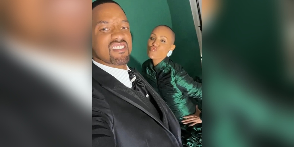 Alopecia: entenda a doença que deixou a mulher de Will Smith sem os fios de cabelo