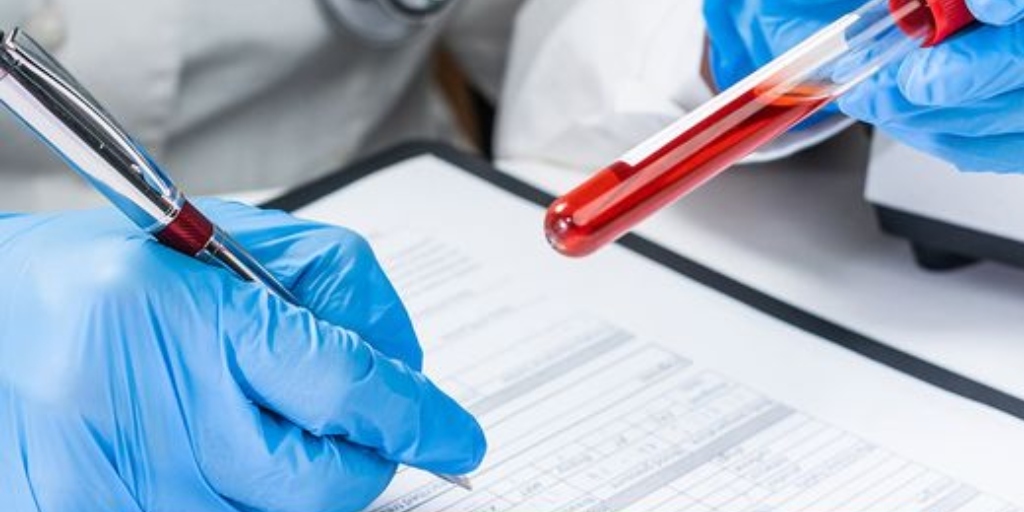 Cabo Frio offers testing in several health units 