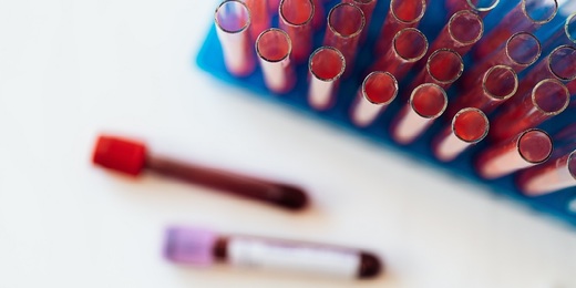Testes rápidos para HIV e sífilis são oferecidos em todas as unidades de saúde de Friburgo até o fim de abril