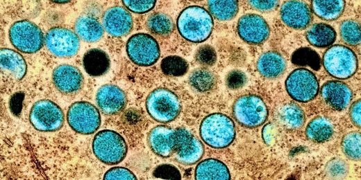 Infectologista explica os riscos da ‘varíola dos macacos’; caso suspeito é investigado na Região dos Lagos