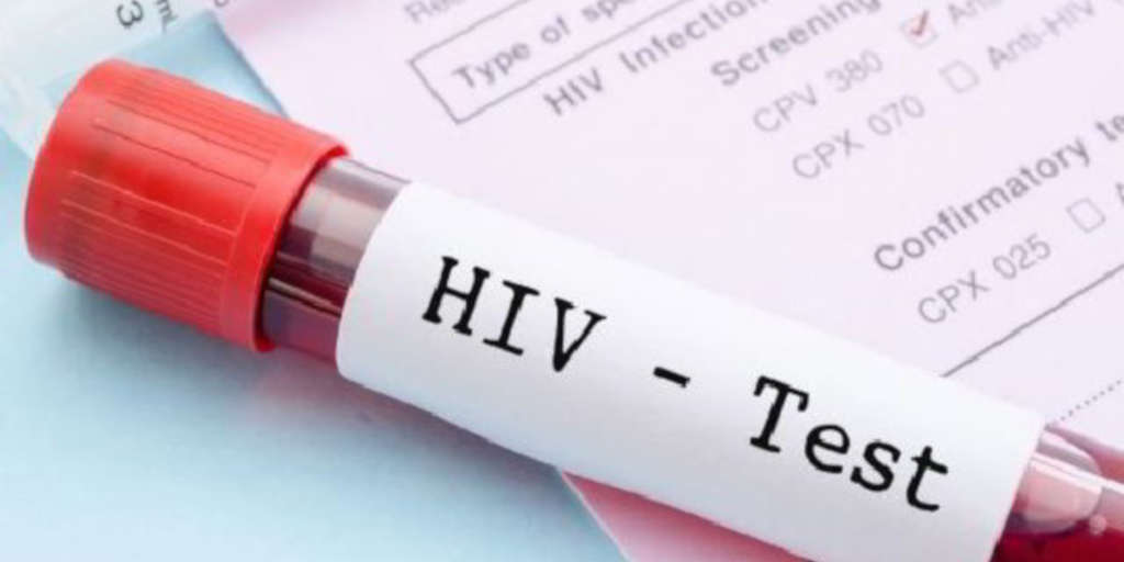 Friburgo terá testes rápidos durante toda a semana pelo Dia Mundial da Luta Contra a Aids