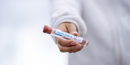 Universidades do Rio de Janeiro participam de parceria que monitora avanço da pandemia
