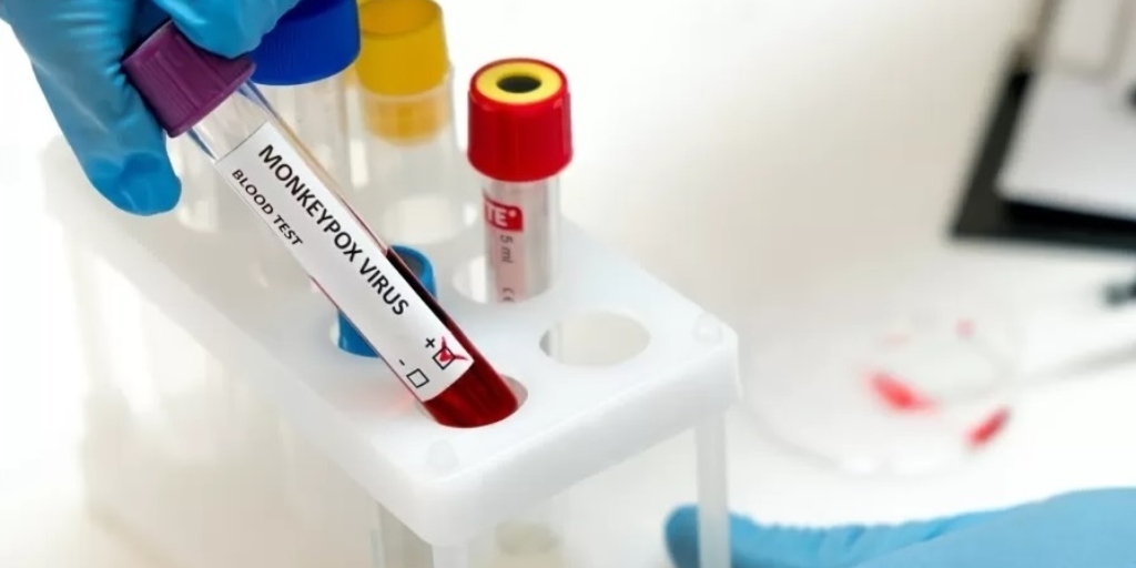 Uso emergencial de kits para diagnóstico de varíola dos macacos é liberado pela Anvisa
