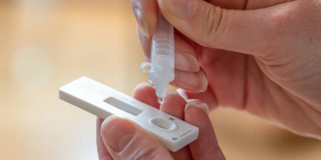 Tem sintomas de Covid ou gripe? veja locais para fazer testes de graça na Região dos Lagos