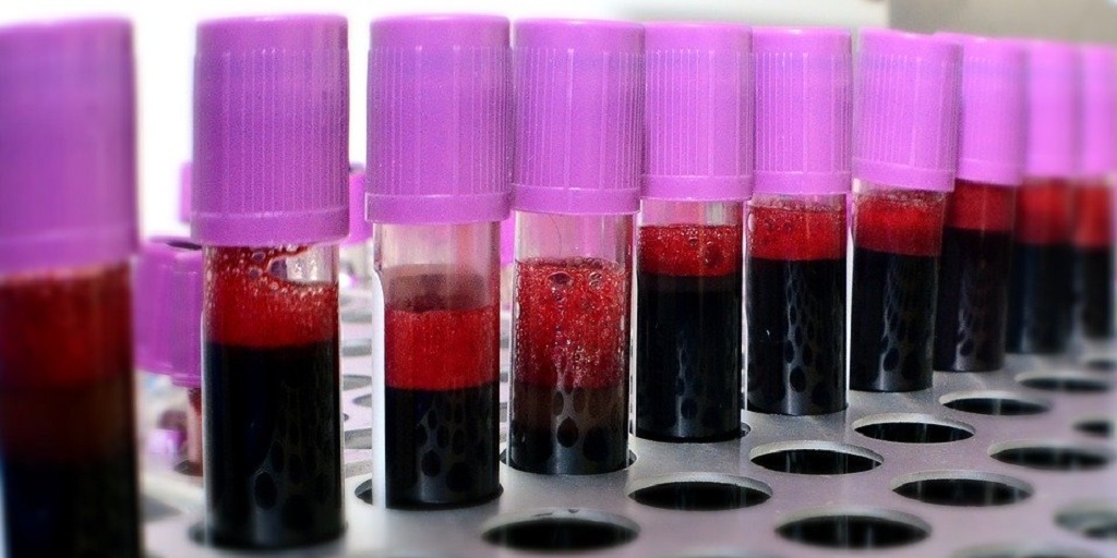 Coronavírus: Nova Friburgo suspende campanha para cadastro de doadores de medula óssea