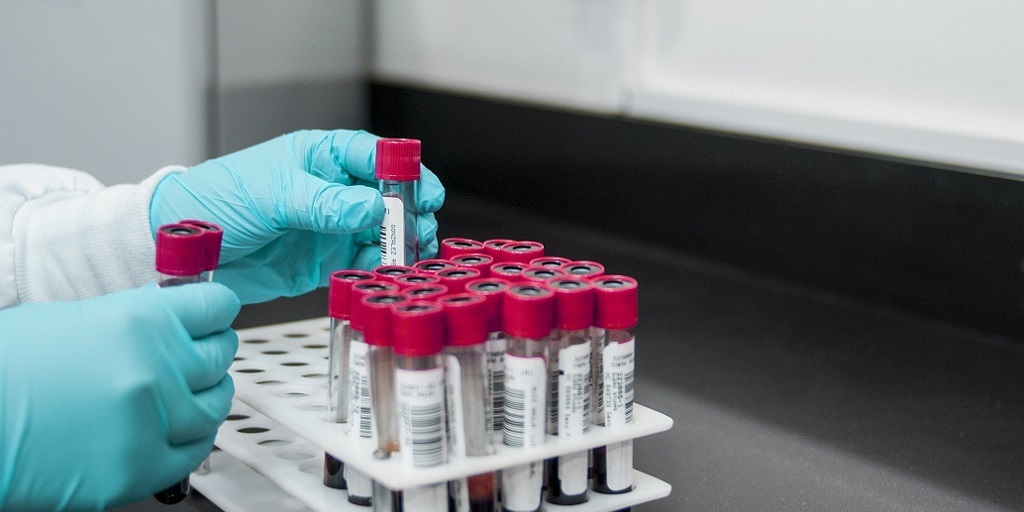 Nova Friburgo se aproxima dos 500 casos confirmados do novo coronavírus