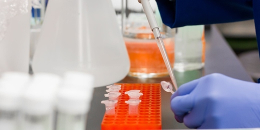 Coronavírus: testagem é o melhor caminho para frear a pandemia