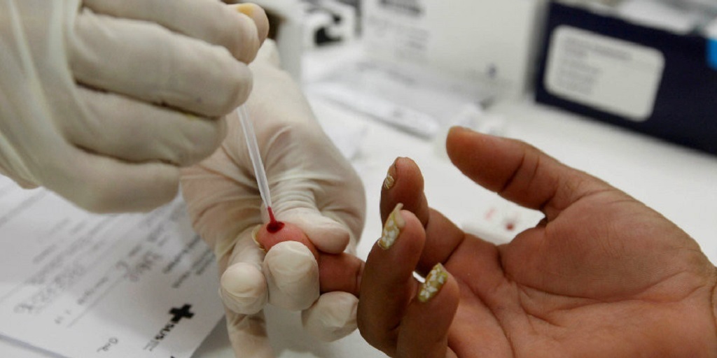 Nova lei estimula a realização de testes rápidos para doenças sexualmente transmissíveis