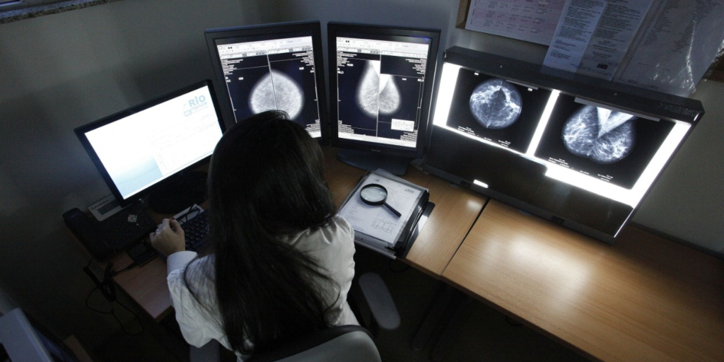 Outubro Rosa: Mamografias gratuitas podem ser feitas durante todo o mês no Rio Imagem