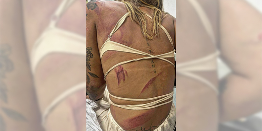 Assessora trans de vereadora Benny Briolly é agredida a pauladas por cinco homens na saída de bar em Cabo Frio